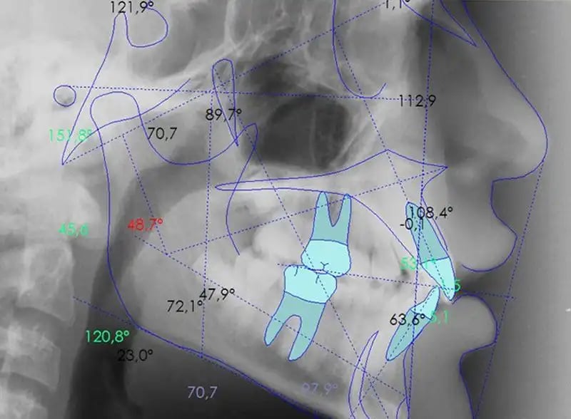 3d-xray-orthodontics