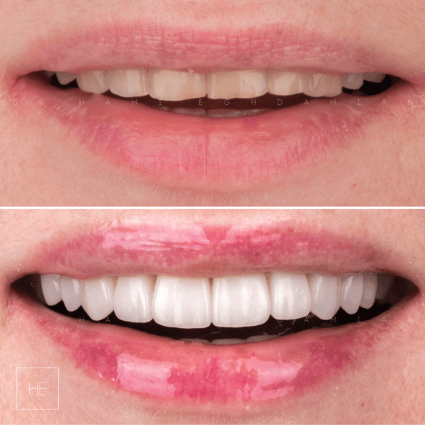 Svetlana Before & After