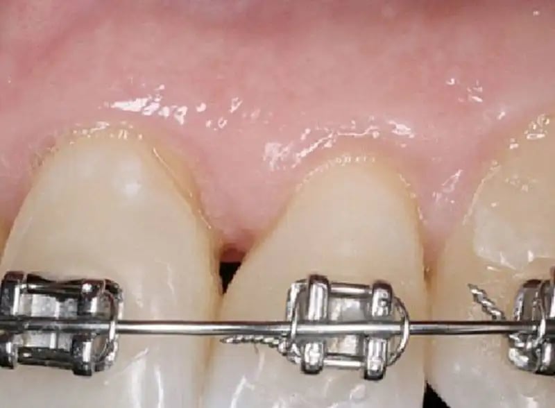 dark-orthodontics