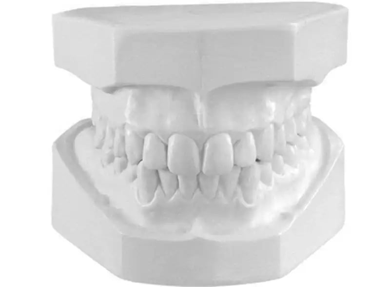 orthodontic-models