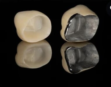zirconium vs. metal ceramic crown
