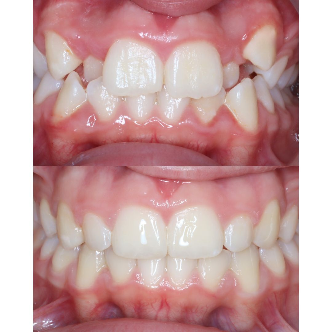 orthodontics marbella