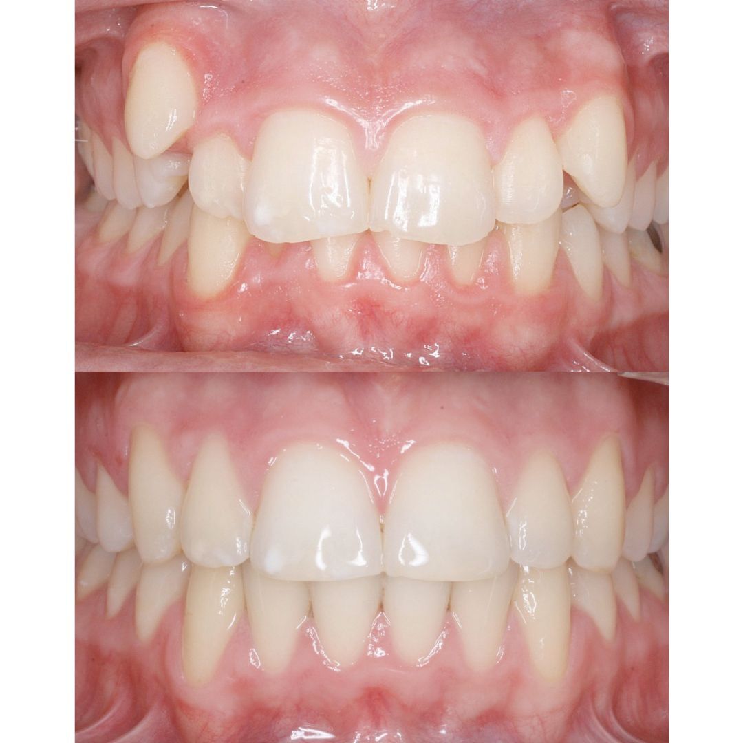 marbella orthodontist