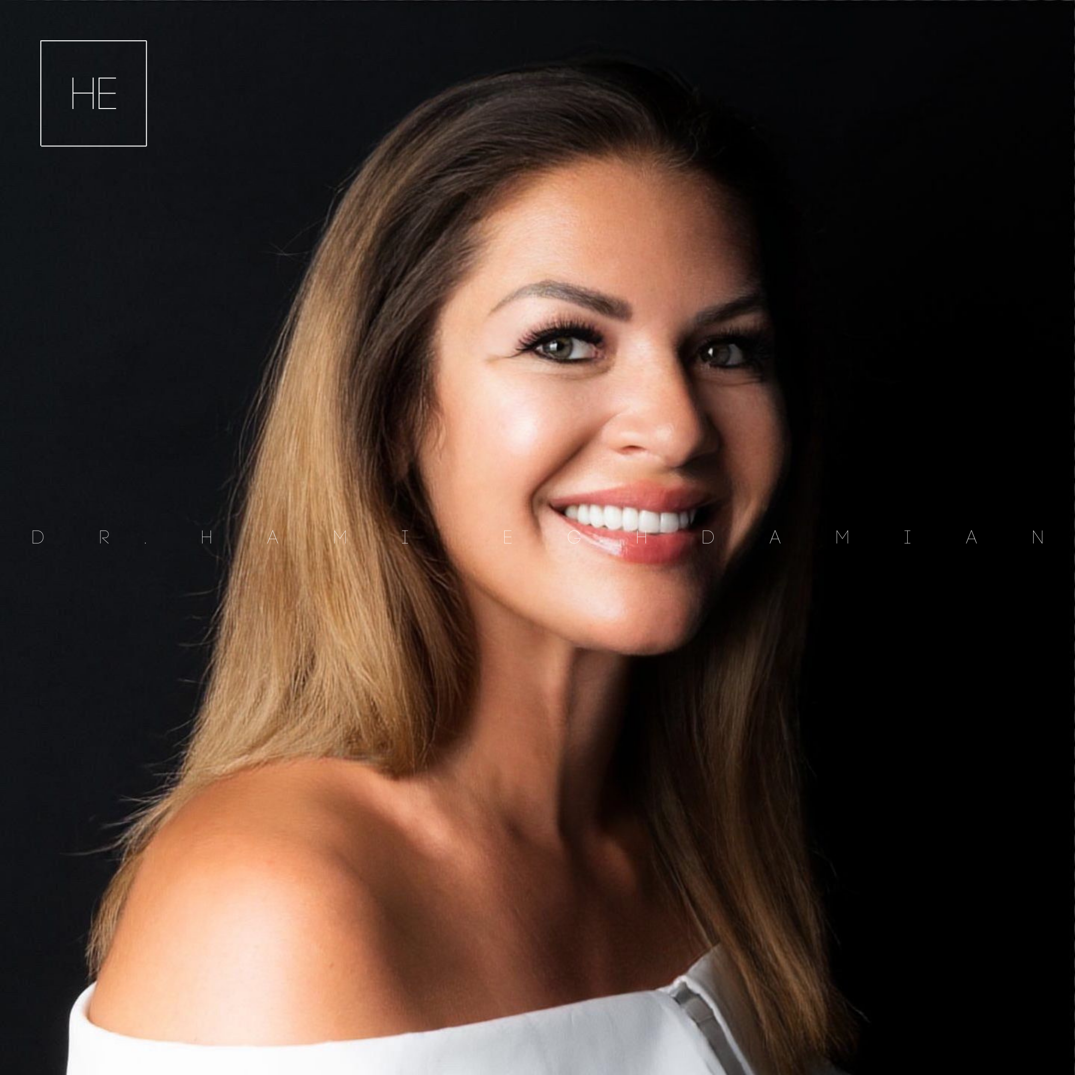 Niculina ceramic veneers marbella