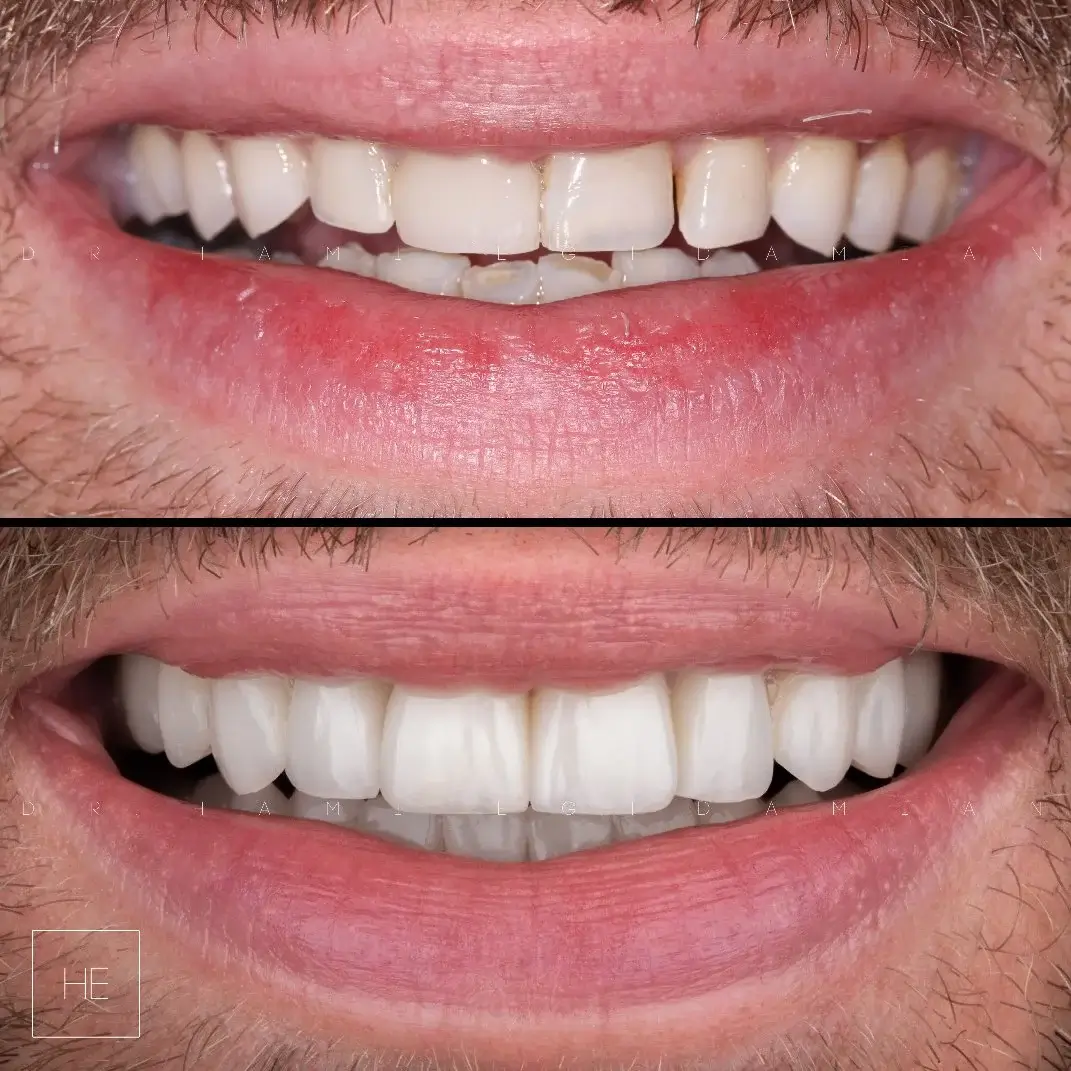 marbella dental clinic gallery