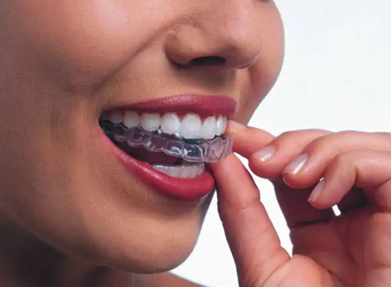 invisalign orthodontic clinic near me