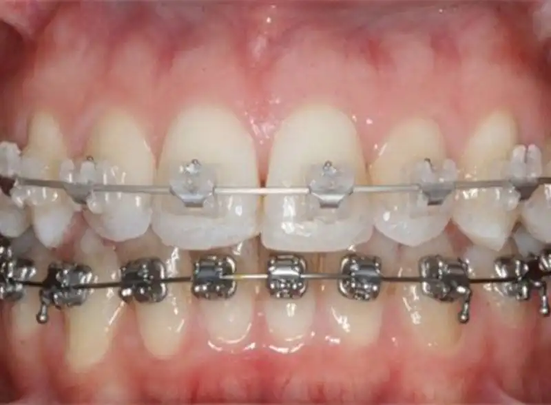 orthodontists in marbella
