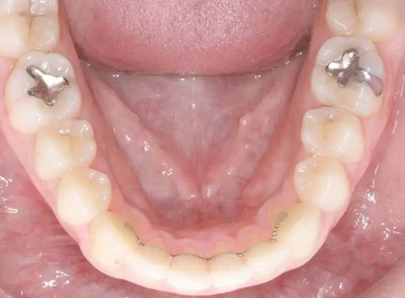 clinica dental ortodoncia marbella