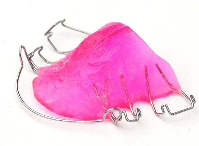 removable-orthodontics-1