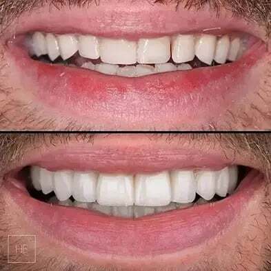 smile-2