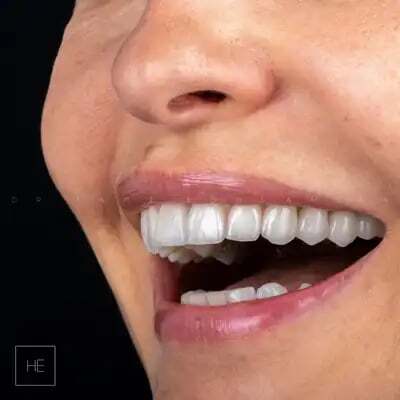 smile-transform-7 (1)