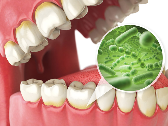dental cleaning Marbella hygienist appointment