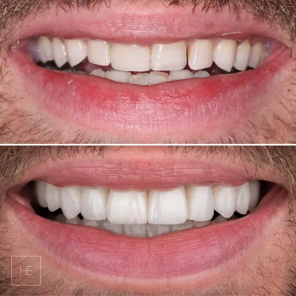 marbella dental clinic