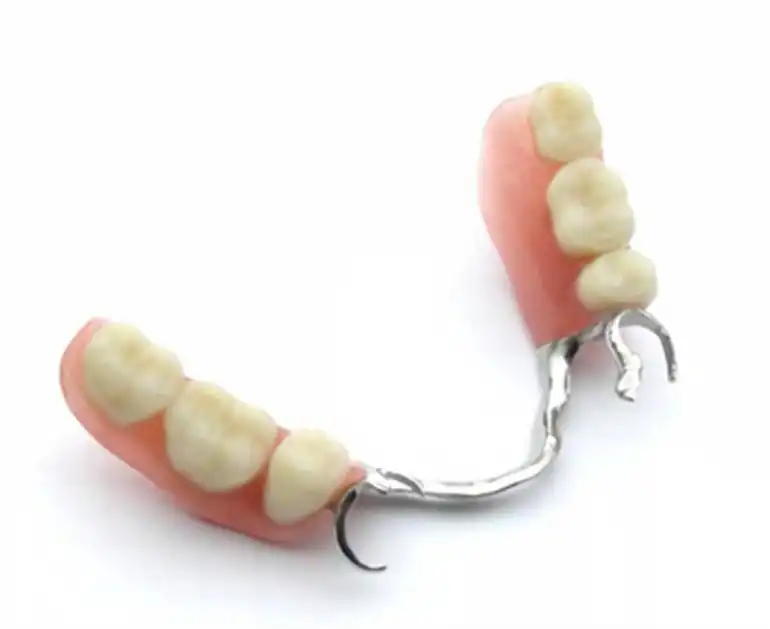 Prótesis parcial para sustituir dientes