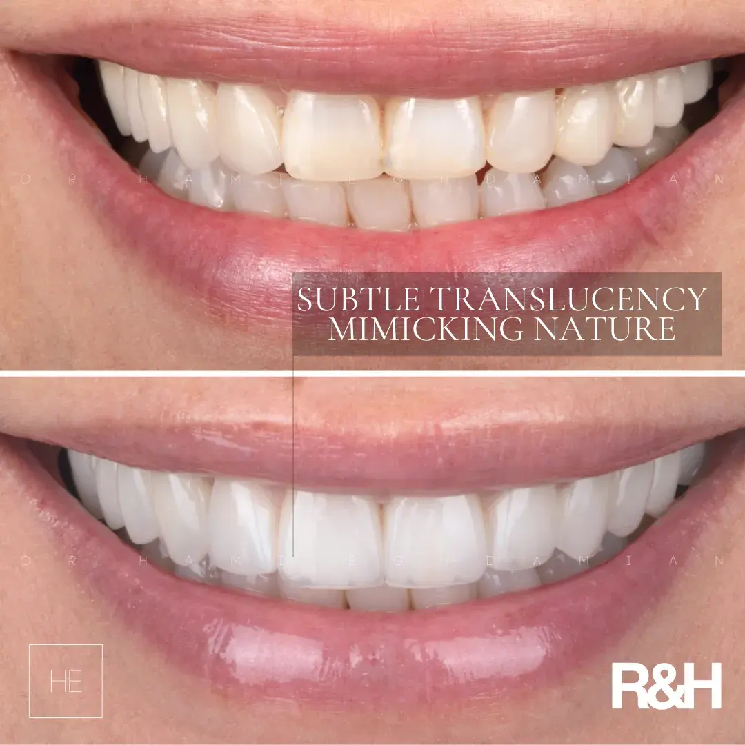 smile-consult-3