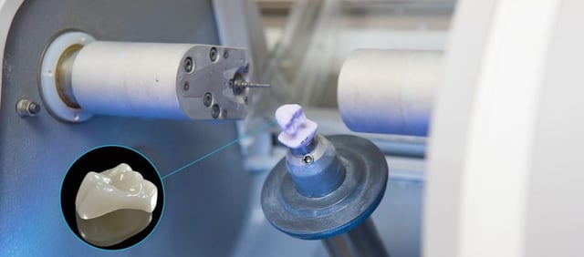 Equipo y proceso digital CEREC conservados de la fuente