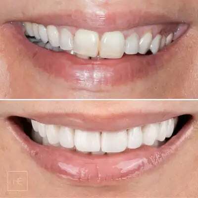 smile-transform-9