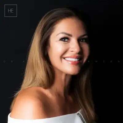 Natural porcelain veneers in Marbella on front teeth