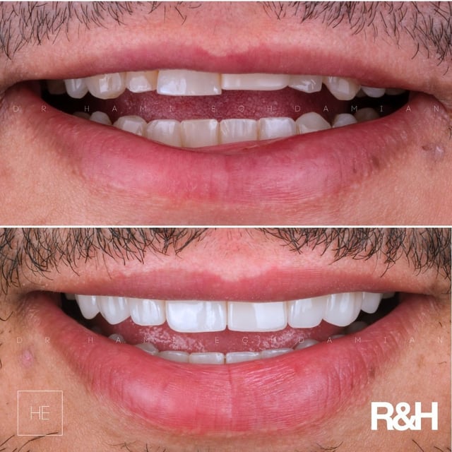 Composición de dos fotografías dentales con marcas de autor conservadas