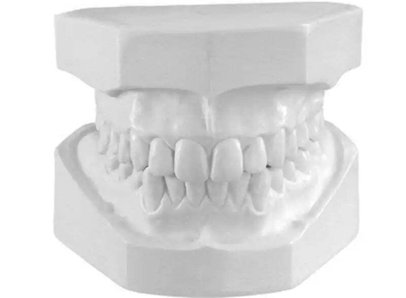 Modelos de estudio dental