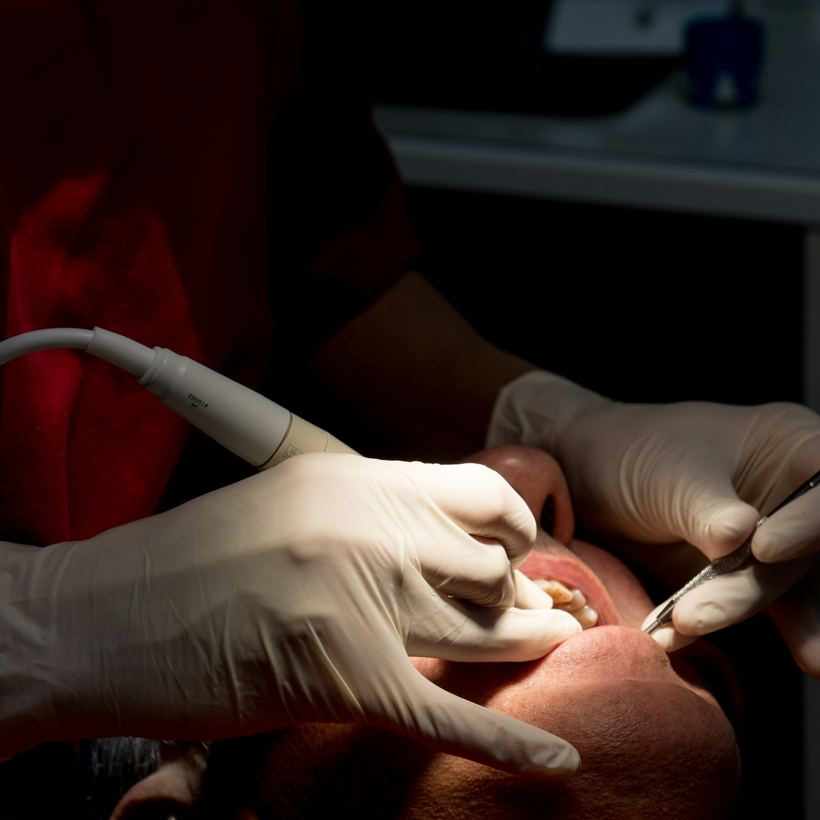 Dental professional using clinical instruments during a professional tooth cleaning