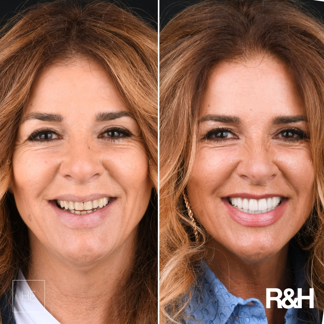 marbella dentist encarna
