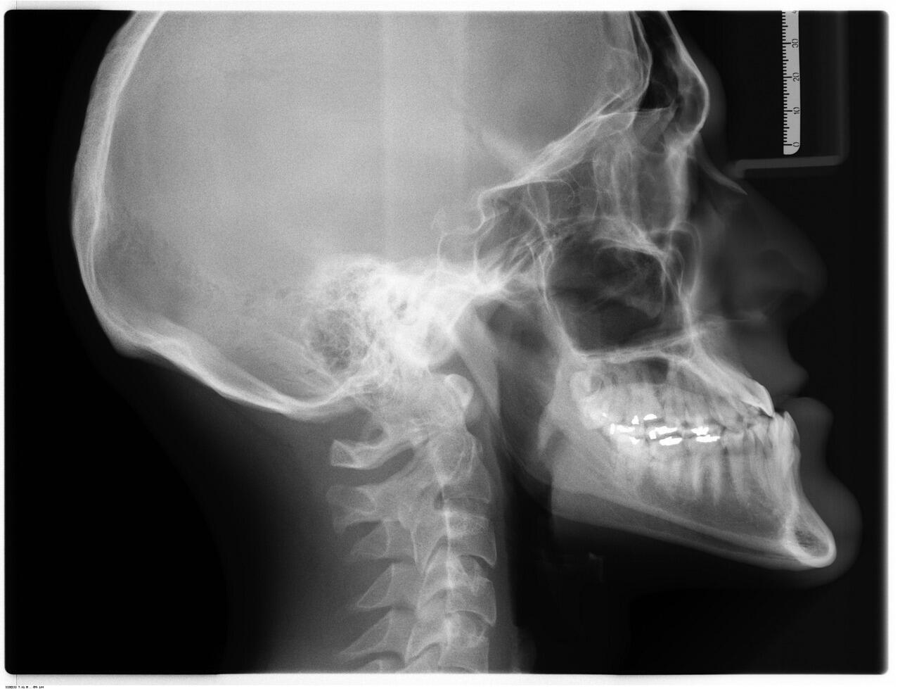 Imagen de una revisión dental procedente de la fuente