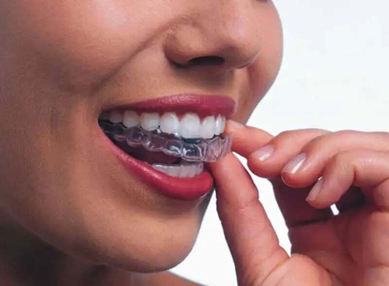 Invisalign
