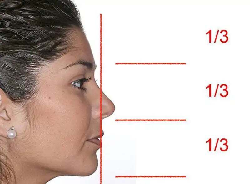 Proporciones faciales