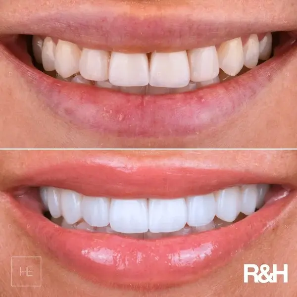 best dentist in Marbella arriana