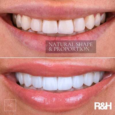 smile-consult-1