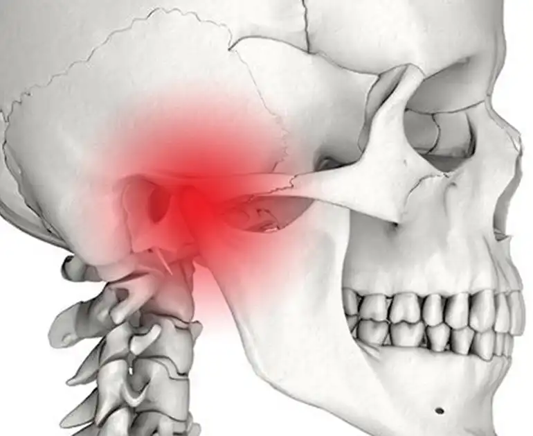Esquema de la articulación temporomandibular en el cráneo