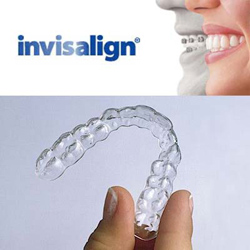 Orthodontic care at R&H Dental Marbella